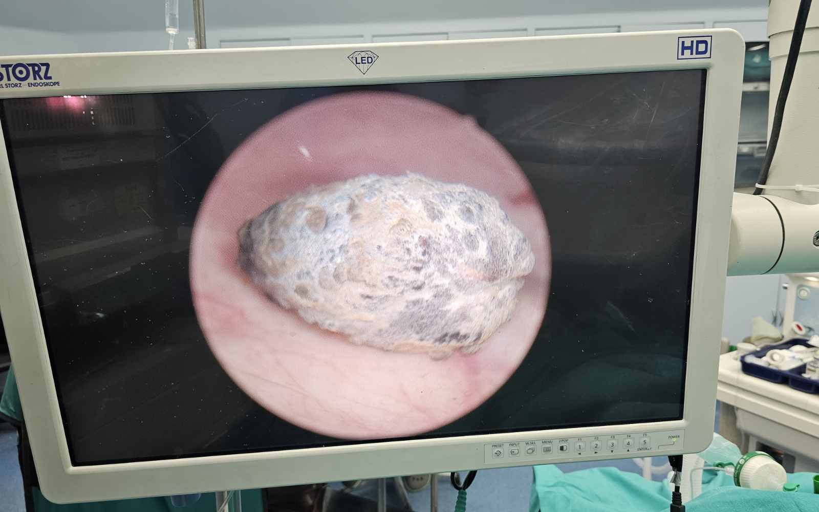 Patient Success Story