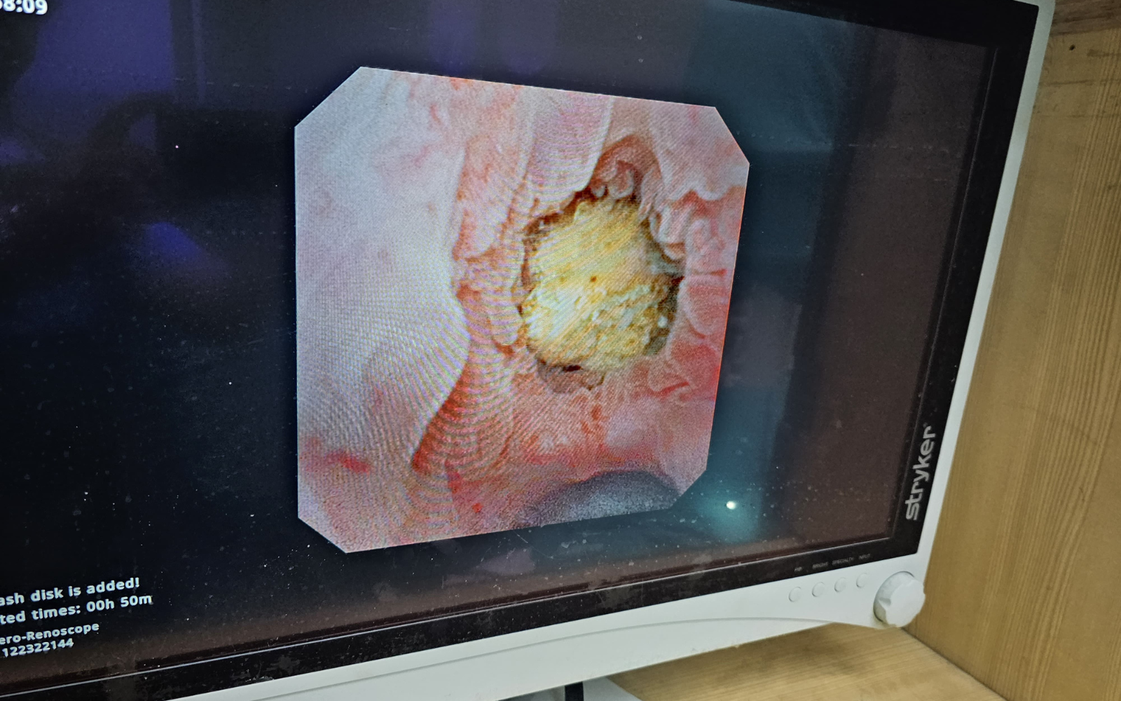 Patient Success Story